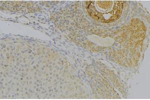 ABIN6277291 at 1/100 staining Human uterus tissue by IHC-P. (NRP2 antibody  (N-Term))