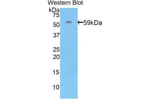 Western Blotting (WB) image for anti-Perforin 1 (Pore Forming Protein) (PRF1) (AA 32-316) antibody (ABIN1860311) (Perforin 1 antibody  (AA 32-316))