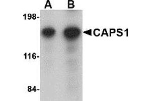 Western Blotting (WB) image for anti-Ca++-Dependent Secretion Activator (CADPS) (N-Term) antibody (ABIN1031290) (CADPS antibody  (N-Term))