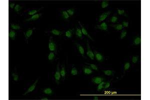 Immunofluorescence (IF) image for anti-SMAD Family Member 4 (SMAD4) (AA 1-552) antibody (ABIN561723)