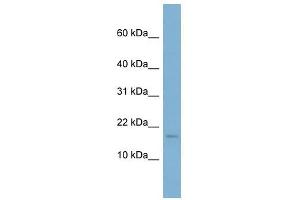 RPS13 antibody used at 1 ug/ml to detect target protein. (RPS13 antibody  (N-Term))