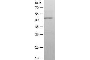 Western Blotting (WB) image for gamma-aminobutyric Acid (GABA) A Receptor, alpha 1 (GABRA1) (AA 28-236) protein (His-IF2DI Tag) (ABIN7123050) (GABRA1 Protein (AA 28-236) (His-IF2DI Tag))