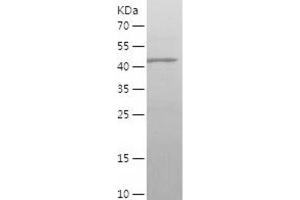 GABRA1 Protein (AA 28-236) (His-IF2DI Tag)