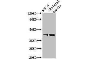 Western Blot Positive WB detected in: MCF-7 whole cell lysate, Mouse skeletal muscle tissue All lanes: USP18 antibody at 2 μg/mL Secondary Goat polyclonal to rabbit IgG at 1/50000 dilution Predicted band size: 44, 42 kDa Observed band size: 44 kDa (USP18 antibody  (C-Term))