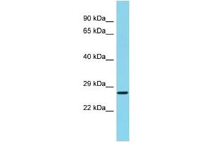 Host: Rabbit Target Name: C22orf13 Sample Type: Fetal Liver lysates Antibody Dilution: 1. (C22orf13 antibody  (C-Term))