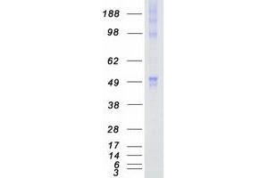Western Blotting (WB) image for Calcium/calmodulin-Dependent Protein Kinase IG (CAMK1G) protein (Myc-DYKDDDDK Tag) (ABIN2713086)