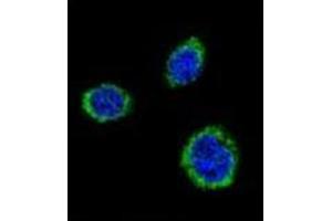 Confocal immunofluorescent analysis of GAD2 / GAD65 Antibody (Center) Cat. (GAD65 antibody  (Middle Region))