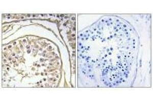 Immunohistochemistry analysis of paraffin-embedded human testis tissue using BAGE2 antibody. (BAGE2 antibody)