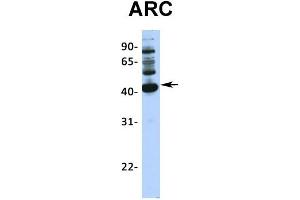 Host:  Rabbit  Target Name:  ARC  Sample Type:  293T  Antibody Dilution:  1.