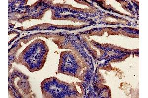 Immunohistochemistry analysis of human prostate tissue using ABIN7174228 at dilution of 1:100 (Ubiquilin 2 antibody  (AA 473-542))