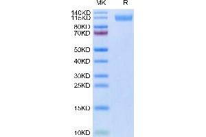SARS-COV-2 Spike S1(B. (SARS-CoV-2 Spike S1 Protein (B.1.640) (His tag))