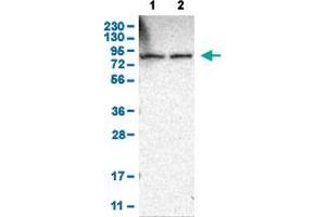 Western Blot analysis of (1) human cell line RT-4, and (2) human cell line U-251MG sp. (THOC1 antibody  (AA 154-240))
