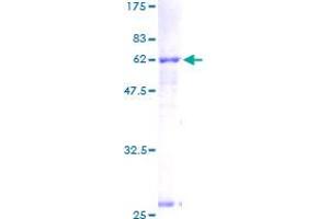 ACAT2 Protein (AA 1-397) (GST tag)