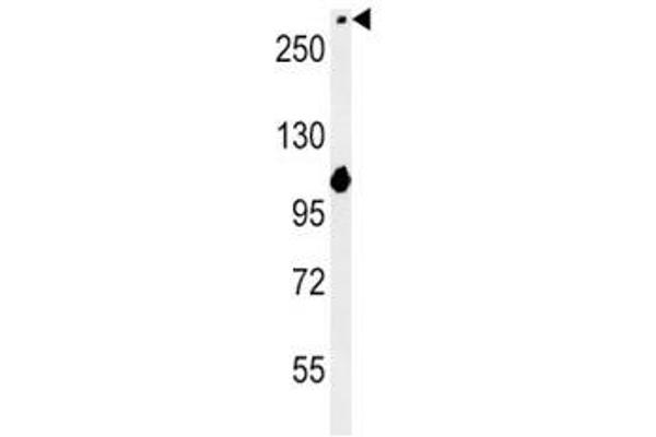 NOTCH3 antibody  (AA 2291-2321)