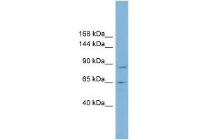 WB Suggested Anti-MGC16169 Antibody Titration:  0. (TBCK antibody  (Middle Region))