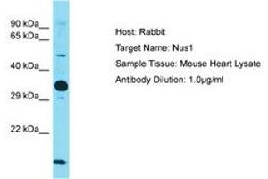 Image no. 1 for anti-Nogo B Receptor (NUS1) (AA 151-200) antibody (ABIN6750531) (Nogo B Receptor antibody  (AA 151-200))