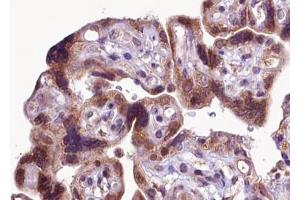 Immunohistochemistry (IHC) image for anti-Fibroblast Growth Factor Receptor 1 (FGFR1) (pTyr766) antibody (ABIN6256027)