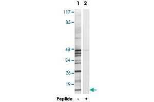 Western blot analysis of extracts from K-562 cells, using MRPS18C polyclonal antibody .