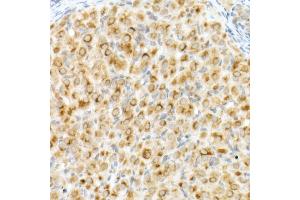 Immunohistochemistry of paraffin-embedded rat ovary using Cation-independent M6PR (IGF2R) antibody (ABIN7267905) at dilution of 1:200 (40x lens). (IGF2R antibody)