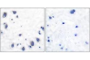 Immunohistochemistry analysis of paraffin-embedded human brain tissue, using Tyrosine Hydroxylase (Ab-40) Antibody. (Tyrosine Hydroxylase antibody  (AA 41-90))