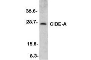 Western blot analysis of CIDE-A in mouse heart tissue lysate with AP30230PU-N CIDE-A antibody at 1/500 dilution. (CIDEA antibody  (C-Term))