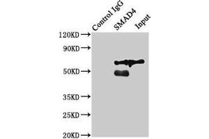 Immunoprecipitating SMAD4 in Jurkat whole cell lysate Lane 1: Rabbit control IgG (1 μg) instead of ABIN7160238 in Jurkat whole cell lysate. (SMAD4 antibody  (AA 27-195))