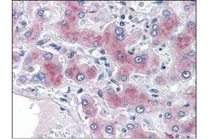 Human Liver (formalin-fixed, paraffin-embedded) stained with PCK1at 2 µg/ml followed by biotinylated anti-goat IgG secondary antibody, alkaline phosphatase-streptavidin and chromogen. (PCK1 antibody  (Internal Region))