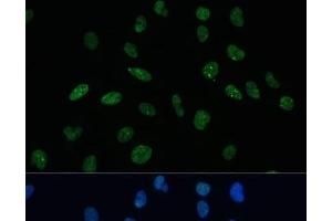 Immunofluorescence analysis of U-2 OS cells using MKL1 Polyclonal Antibody at dilution of 1:100 (40x lens). (MKL1 antibody)
