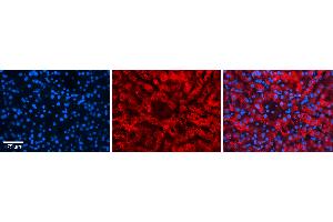 Rabbit Anti-FKBP8 Antibody Catalog Number: ARP46862_P050 Formalin Fixed Paraffin Embedded Tissue: Human Liver Tissue Observed Staining: Cytoplasm in hepatocytes Primary Antibody Concentration: 1:100 Other Working Concentrations: N/A Secondary Antibody: Donkey anti-Rabbit-Cy3 Secondary Antibody Concentration: 1:200 Magnification: 20X Exposure Time: 0. (FKBP8 antibody  (N-Term))