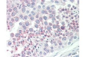 Anti-IGFBP1 antibody IHC staining of human testis. (IGFBPI antibody  (AA 156-170))