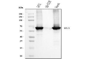 Western blot analysis of Cytokeratin 5 using anti-Cytokeratin 5 antibody (ABIN7602992).