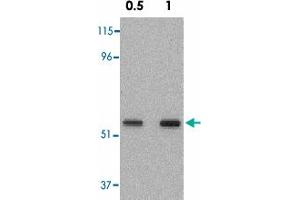 Western blot analysis of SKIL in A-431 cell lysate with SKIL polyclonal antibody  at 0. (SKIL antibody  (N-Term))