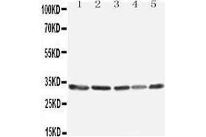 Western Blotting (WB) image for anti-Tumor Necrosis Factor, alpha-Induced Protein 8-Like 3 (TNFAIP8L3) (AA 273-292), (C-Term) antibody (ABIN3042574) (TNFAIP8L3 antibody  (C-Term))