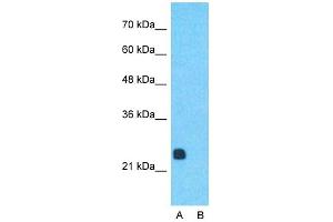 Host:  Rabbit  Target Name:  RCAN1  Sample Type:  Human Fetal Muscle  Lane A:  Primary Antibody  Lane B:  Primary Antibody + Blocking Peptide  Primary Antibody Concentration:  1ug/ml  Peptide Concentration:  5ug/ml  Lysate Quantity:  25ug/lane/lane  Gel Concentration:  0. (RCAN1 antibody  (Middle Region))