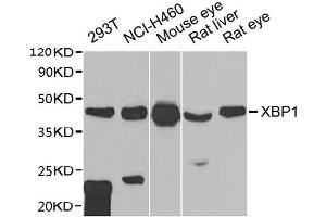 Western blot All lanes: XBP1 antibody at 1:1000 dilution Lane 1: 293T whole cell lysate Lane 2: NCI-H460 whole cell lysate Lane 3: Mouse eye tissue Lane 4: Rat liver tissue Lane 5: Rat eye tissue Secondary Goat polyclonal to rabbit IgG at 1/10000 dilution Predicted band size: 29, 41 kDa Observed band size: 41 kDa (XBP1 antibody  (AA 1-261))
