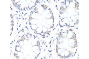 Immunohistochemistry of paraffin-embedded Human colon using SDHB Polyclonal Antibody at dilution of 1:100 (40x lens). (SDHB antibody)
