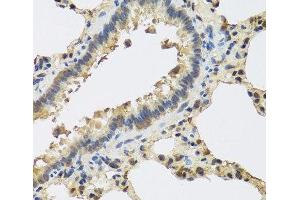 Immunohistochemistry of paraffin-embedded Rat lung using IL25 Polyclonal Antibody at dilution of 1:100 (40x lens). (IL-25 antibody)