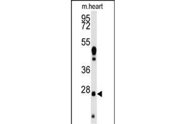 WDYHV1 Antikörper  (AA 106-136)