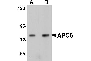 Western Blotting (WB) image for anti-Anaphase Promoting Complex Subunit 5 (ANAPC5) (Middle Region) antibody (ABIN1030862) (ANAPC5 antibody  (Middle Region))