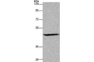 Western blot analysis of Mouse brain tissue, using ETS2 Polyclonal Antibody at dilution of 1:500 (ETS2 antibody)