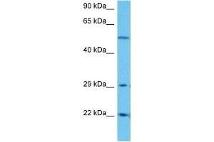 Host:  Rabbit  Target Name:  SLC25A4  Sample Tissue:  Human DLD1 Whole Cell  Antibody Dilution:  1ug/ml (SLC25A4 antibody  (N-Term))