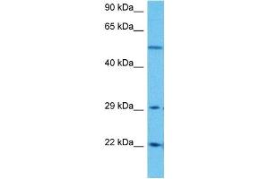 Host:  Rabbit  Target Name:  SLC25A4  Sample Tissue:  Human DLD1 Whole Cell  Antibody Dilution:  1ug/ml