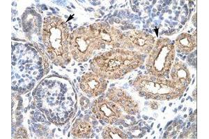 Image no. 3 for anti-Homeobox D3 (HOXD3) (AA 80-129) antibody (ABIN6735792) (HOXD3 antibody  (AA 80-129))