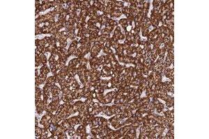 Immunohistochemical staining of human liver with PPP1R12C polyclonal antibody  shows strong cytoplasmic positivity in hepatocytes.