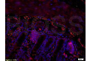Formalin-fixed and paraffin embedded mouse small intestine tissue labeled with Rabbit Anti-PACAP-38 Polyclonal Antibody (ABIN726215), Unconjugated at 1:200 followed by conjugation to the secondary antibody and DAB staining.