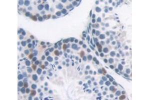 Used in DAB staining on fromalin fixed paraffin- embedded testis tissue (BRD1 antibody  (AA 579-1058))