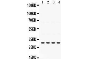 Western Blotting (WB) image for anti-Insulin-Like Growth Factor Binding Protein 3 (IGFBP3) (AA 214-252), (C-Term) antibody (ABIN3043859) (IGFBP3 antibody  (C-Term))