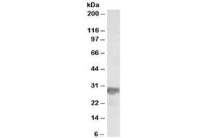 Western blot testing of HeLa lysate with NNMT antibody at 0. (NNMT antibody)