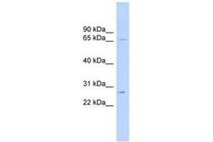 Image no. 1 for anti-Mitochondrial Ribosomal Protein L13 (MRPL13) (AA 107-156) antibody (ABIN6743790) (MRPL13 antibody  (AA 107-156))