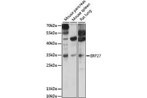 Western blot analysis of extracts of various cell lines, using ERP27 antibody (ABIN7266942) at 1000 dilution. (ERP27 antibody  (AA 1-273))